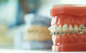 Dental care abroad