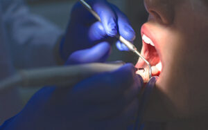 Derbyshire dental patients